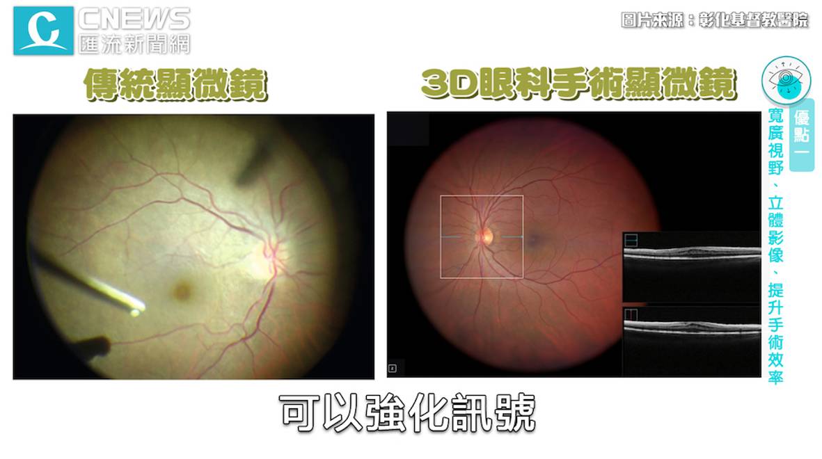 【有影】愛用3C小心眼茫茫!彰基引進3D科技擺脫「三大惡視力」 18 cnews資料照片