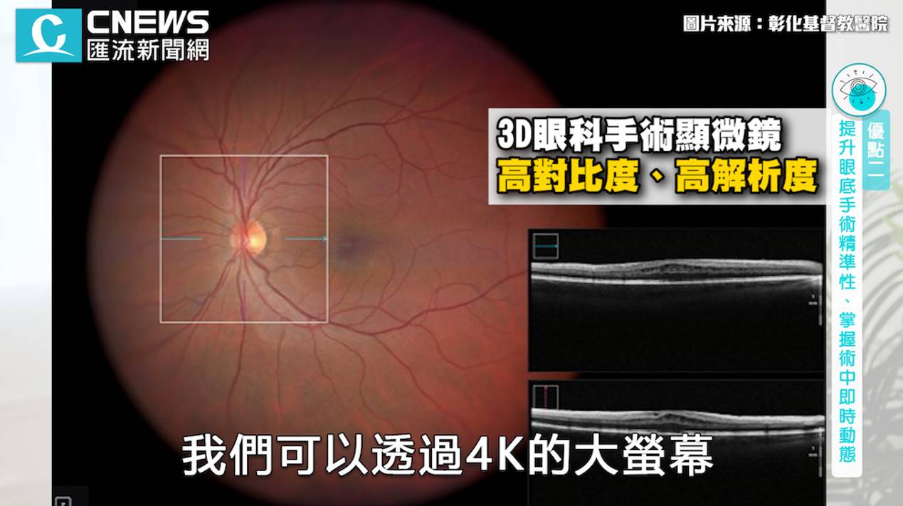 【有影】愛用3C小心眼茫茫!彰基引進3D科技擺脫「三大惡視力」 20 cnews資料照片