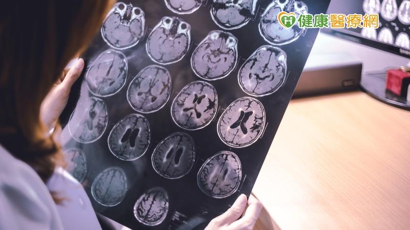 家屬注意！家中失智患者出現「3種情況」要當心