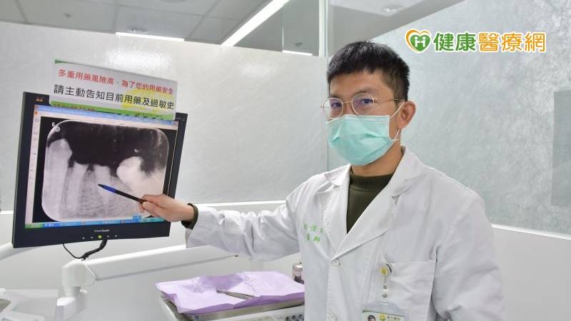 齲齒殘根不治療 重者恐引致命感染