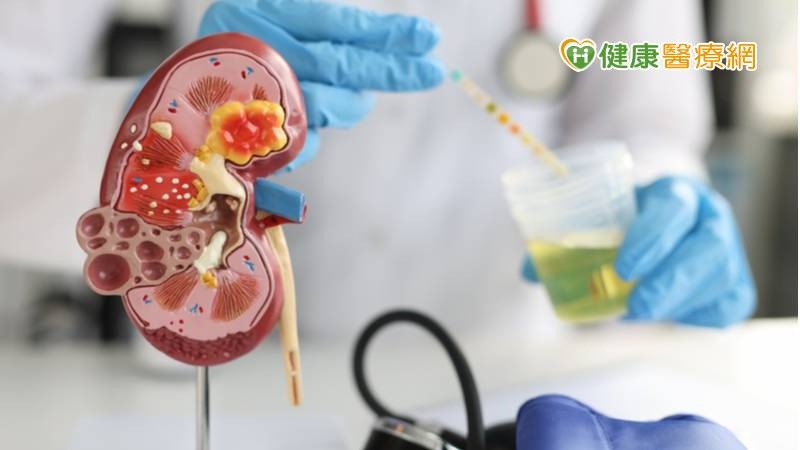 腎病5徵兆中2不可拖 護腎絕招跟著做