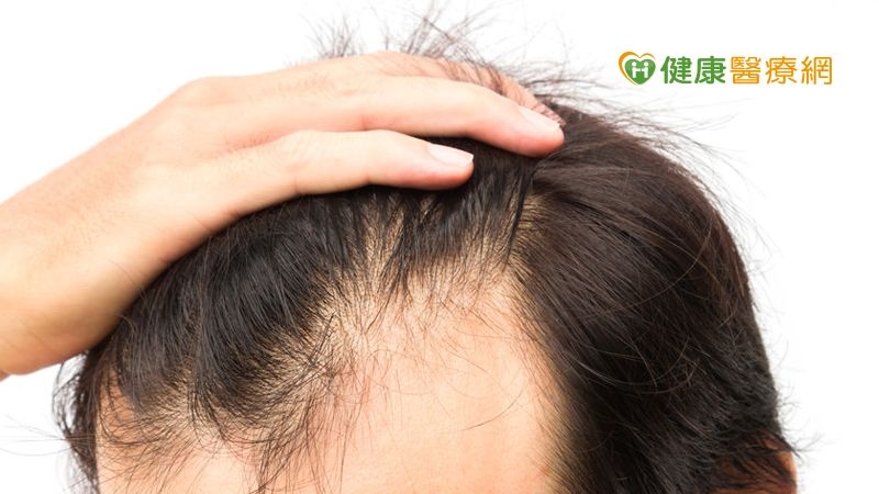 雷射生髮帽有用? 頭皮毛囊甦醒的關鍵是這個