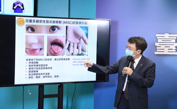 全台數例MIS-C  王志堯院長：請家長留意、盡早送醫
