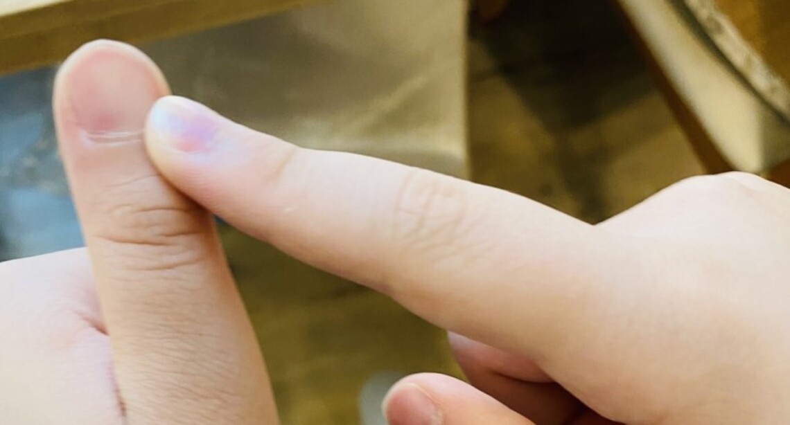 清冠一號缺貨台南市醫中醫依體質治療