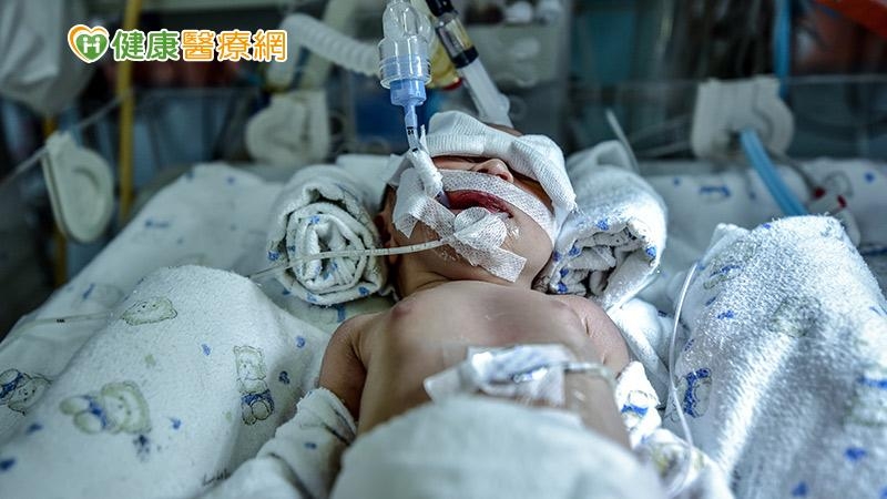 嬰兒出生呼吸不順、面色發白 小心是「胎便吸入症候群」