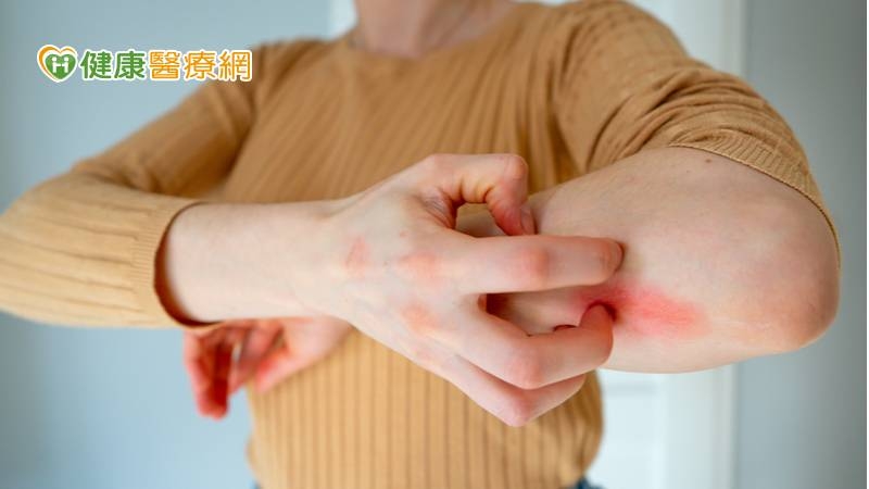 季節交替「異位性皮膚炎」又來了 這樣做改善不適