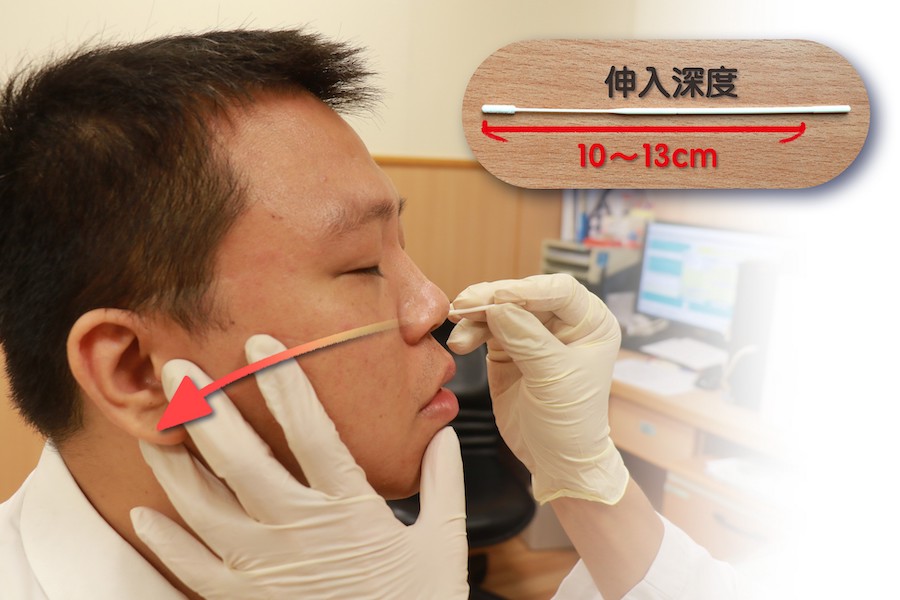 長柄快篩棒成人深入長度約十到十三公分到達鼻咽處。