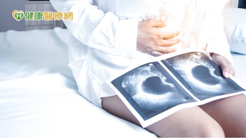 5旬婦人變胖、呼吸喘 驚見巨大卵巢囊腫藏肚