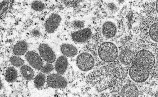 WHO：全球已有50個國家和地區確診3400多例猴痘病例