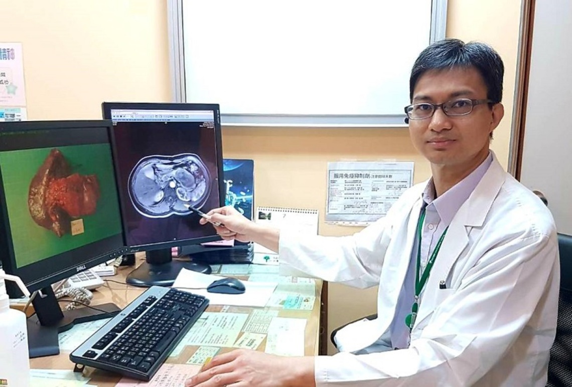 罕見!胰臟尾5cm腫瘤四年後大到8cm還是”沒感覺” 3D腹腔鏡挑戰腫瘤連脾臟切除 順利完成無併發症