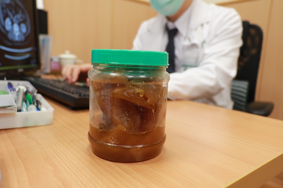阿嬤聽醫師的話,放棄長年食用自製醬菜,改吃新鮮蔬食。