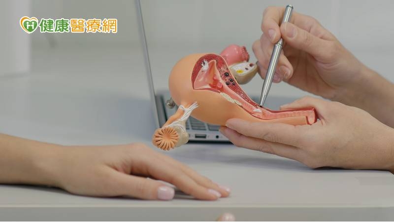 婦停經後出血竟罹子宮內膜癌 2療法精準治療、減輕副作用