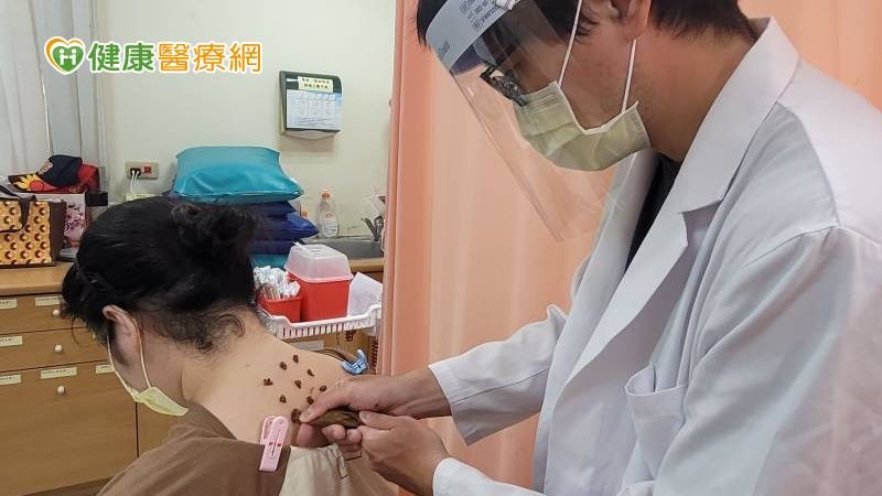確診康復後留呼吸道症狀? 中醫「三伏貼」也能改善