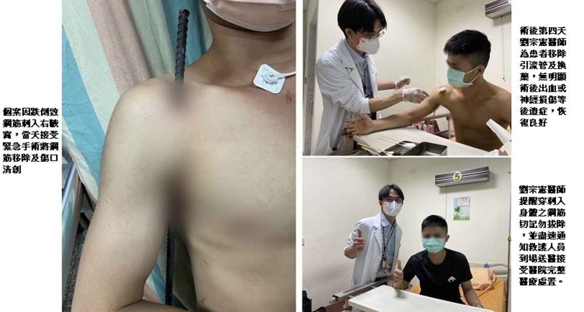 25歲男子遭鋼筋刺入右腋窩 醫師:現場不要拔除鋼筋