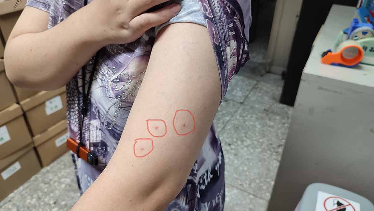 大多數蟎蟲生命期約3周內死亡。受害者呈三顆線狀或三角形排列的咬痕（圖／新北市政府）