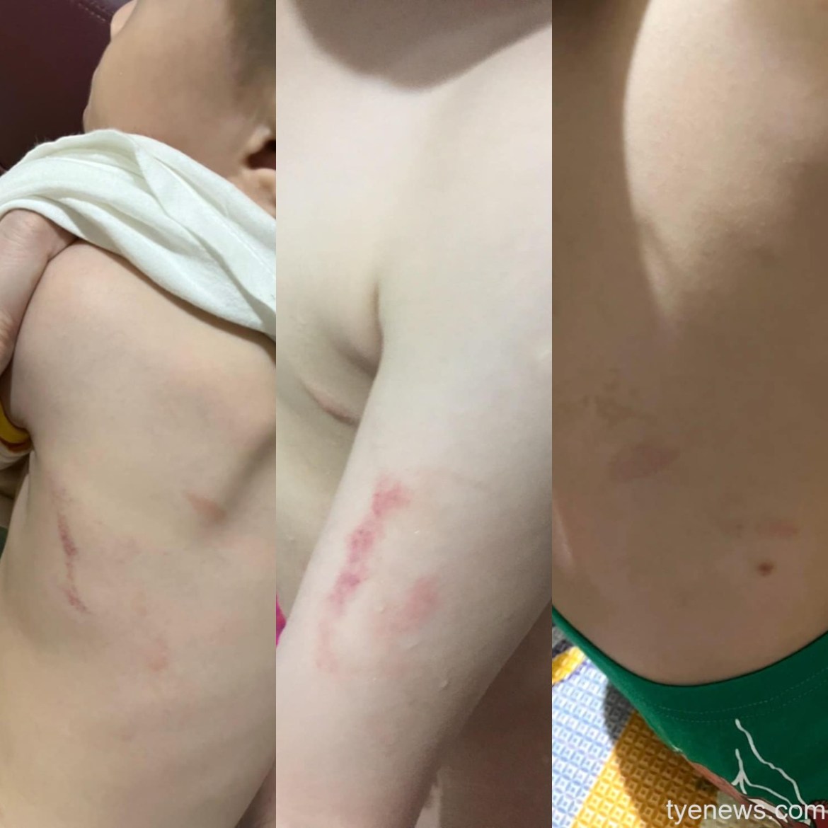 心疼!龍潭區某幼兒園驚爆無照師虐童 賴香伶率受害家屬提6訴求 17 FotoJet 12