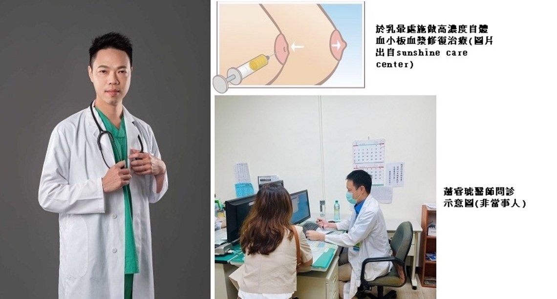 乳房重建後乳頭凹陷感覺喪失 自體血小板血漿治療後恢復愛的感覺