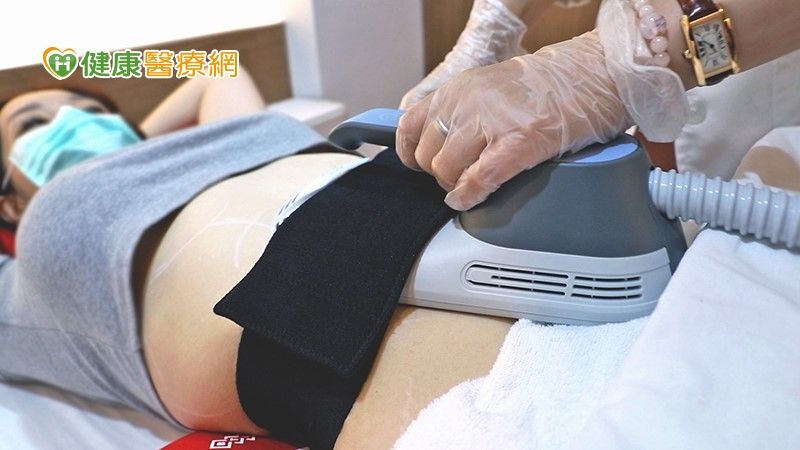 體雕療程新革命 用「熱」減脂又增肌