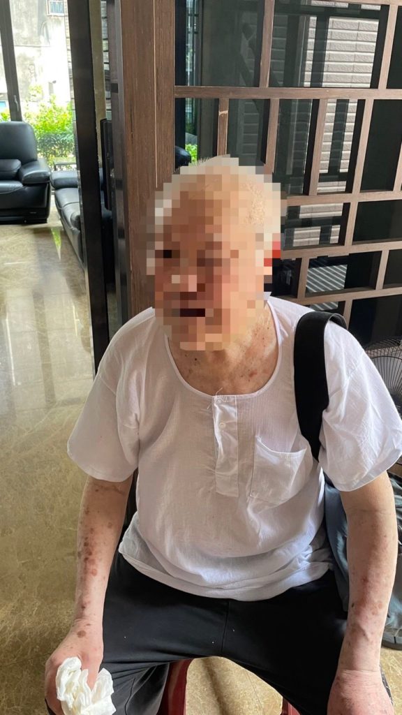 老翁疑似曬到中暑,體力不支倒於路邊,需要警方協助