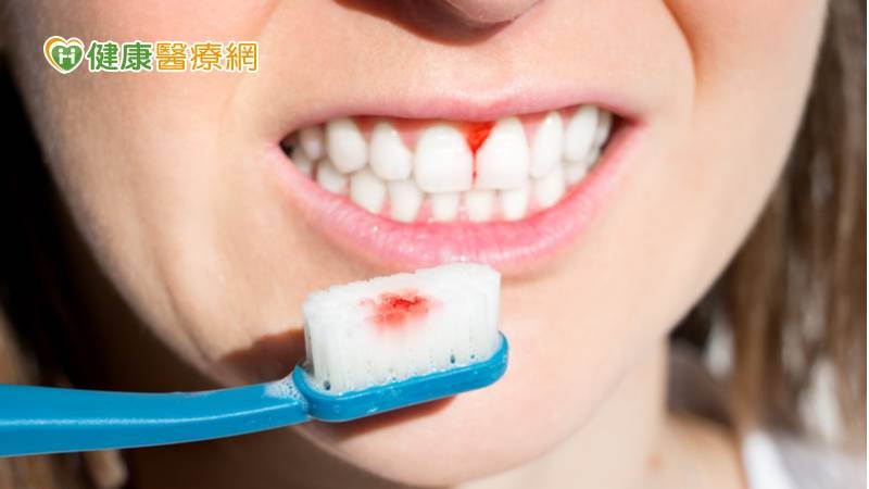 刷牙就流血當心變「無齒」 醫揪2元兇