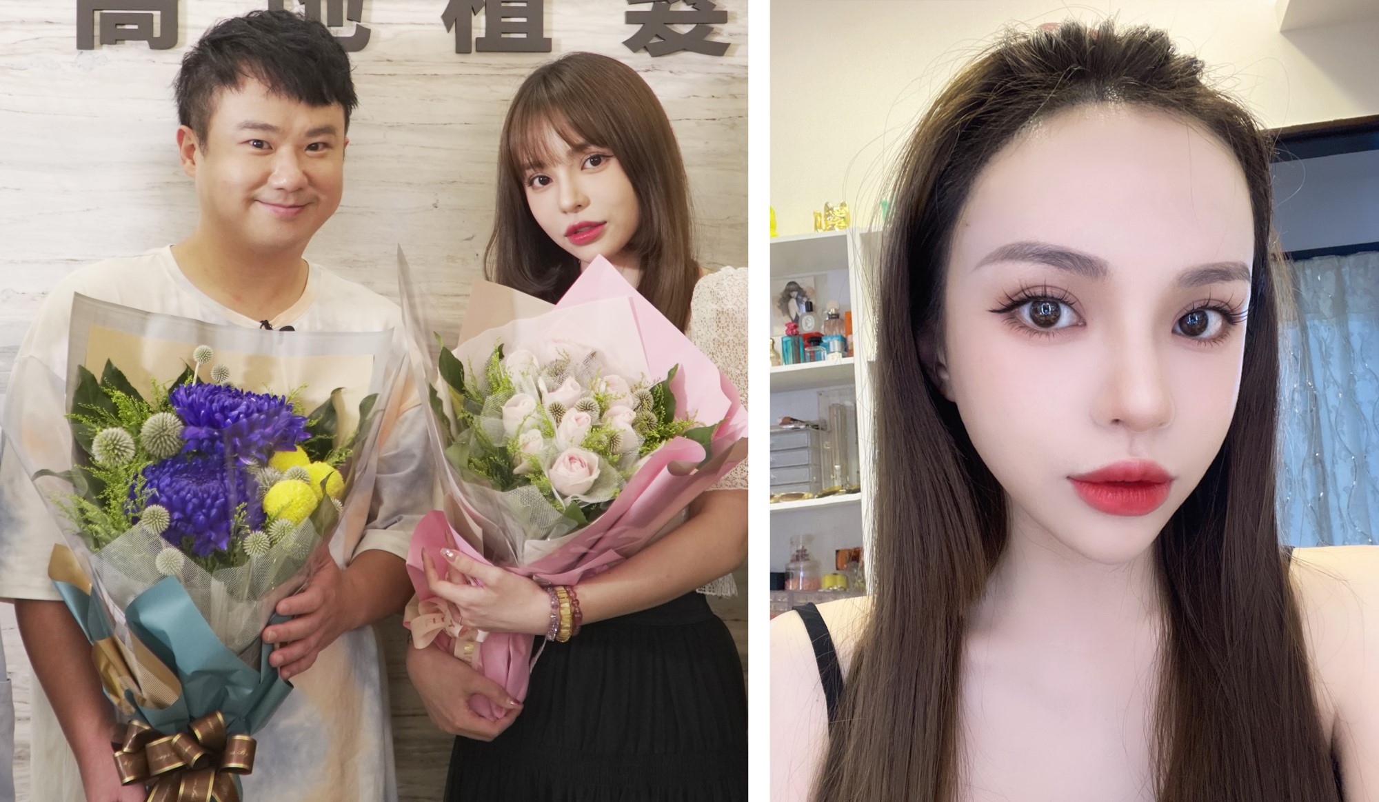 地球 斯亞(術後四天) ，皆由林宜蓉醫師親植!