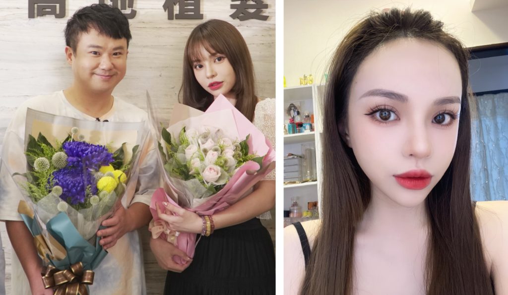 地球 斯亞(術後四天) ,皆由林宜蓉醫師親植!