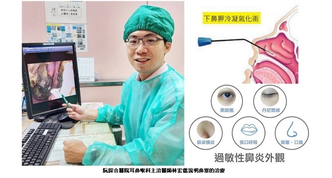 趁暑假在臉上”動手腳”不是只有微整 「下鼻甲冷觸氣化術」從根本解決愛睏目、黑眼圈