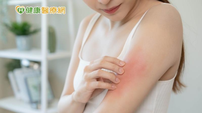 異位性皮膚炎是富貴病?病友媽直呼:簡直「勞命傷財」