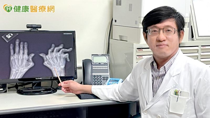 炒菜無法施力 竟是類風濕性關節炎作怪!