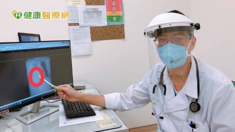 30多歲男發燒、呼吸急促確診肺結核 雙親也驗出潛伏性結核