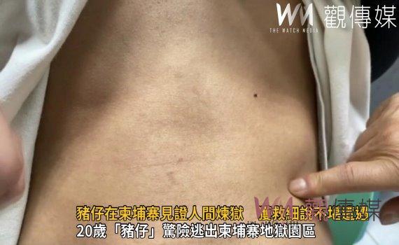 影／阿嬤籌錢救孫　20歲「豬仔」在柬埔寨見證人間煉獄　獲救細說不堪遭遇