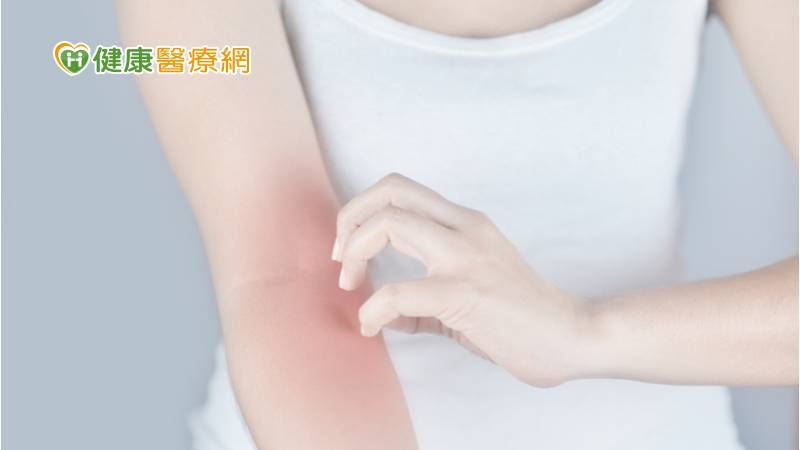 購藥怕用藥過敏 食藥署:標記健保卡更安心