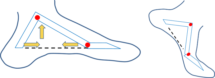 絞盤機制(windlass mechanism),墊腳時足底筋膜向內收縮,足弓向上拱起