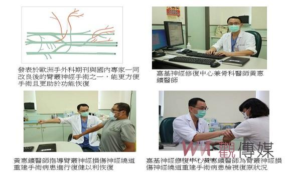 嘉基:臂叢神經損傷繞道重建手術 癱瘓手再次舉重活動