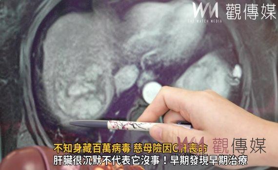 影/肝臟是沉默的器官!不知身藏百萬病毒 慈母險因C肝喪命