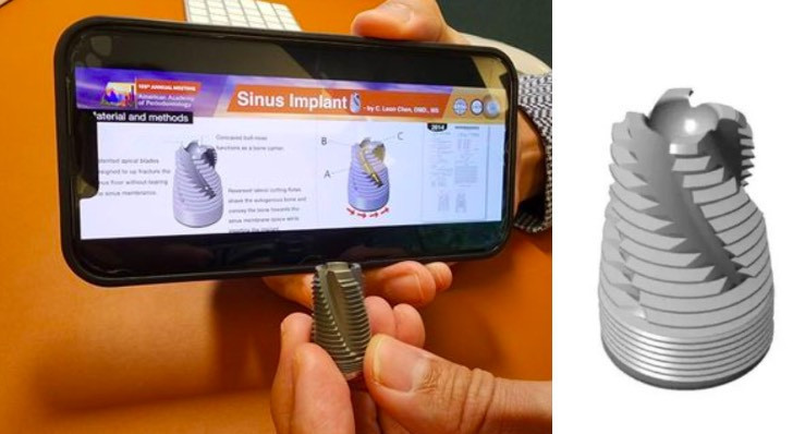 鼻竇植體專利。(圖片來源:星世代公司提供/陳俊龍醫師圖形專利)