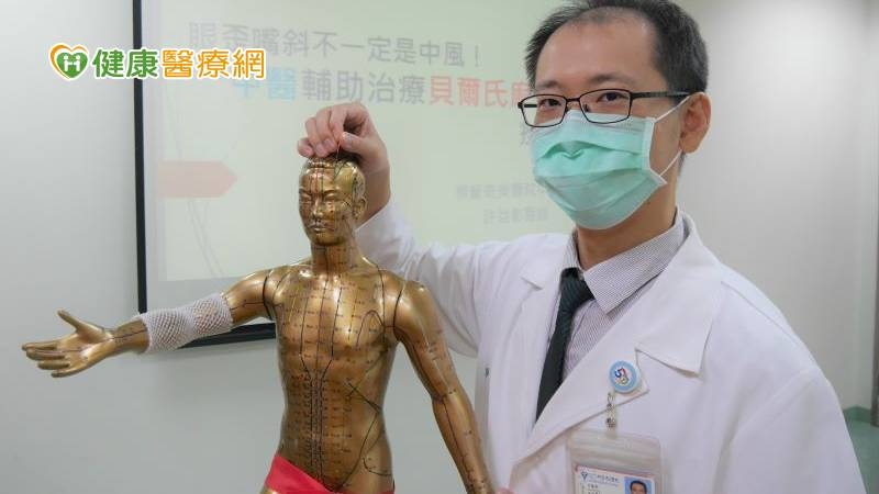 眼歪嘴斜當心是顏面神經麻痺! 中醫輔助治療恢復快