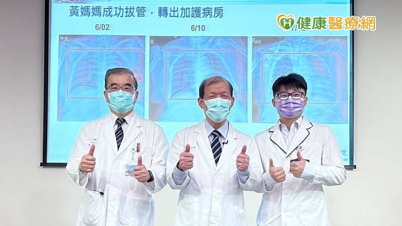 近八旬嬤感染「超級細菌」 AI質譜儀快找抗藥性