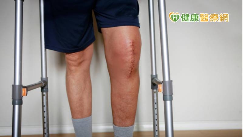 中年茶農採茶腳軟無力 「人工膝關節置換」擺脫疼痛