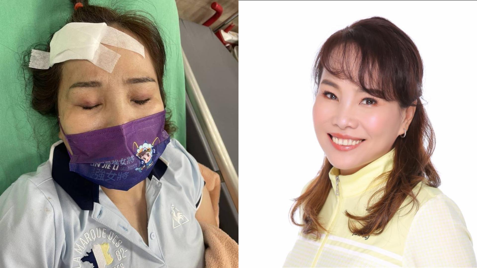 林婕麗今上午在大直派出所前馬路口拜票時遭不明男子攻擊。翻攝新黨打假除亂粉專、林婕麗臉書
