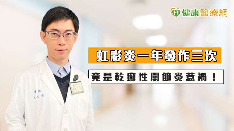 虹彩炎一年發作三次,竟是乾癬性關節炎惹禍!