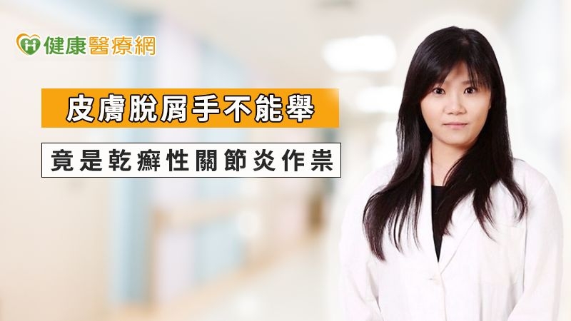 皮膚脫屑手不能舉 竟是乾癬性關節炎作祟