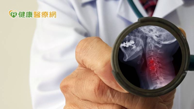 農民「脊椎退化性疾病」嚴重恐影響大小便 奇美成立跨領域照護團隊