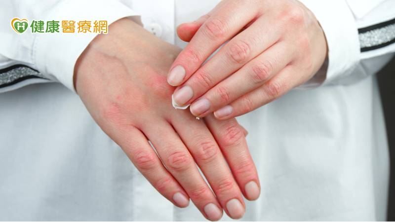 消毒手乾又痛!你可能中了皮膚炎 醫揭5大預警症狀