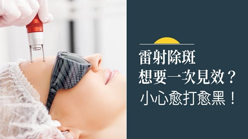 雷射除斑想要一次見效?小心愈打愈黑!