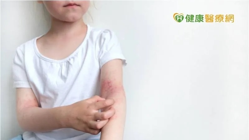 「同學因為我有皮膚病不敢跟我玩」　醫籲1件事，生活品質不打折