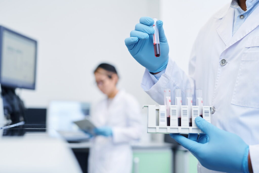 旌德生技研究新型肺癌血液檢測「肺易尋LungDefend」期望為肺癌篩檢帶來新的改變。