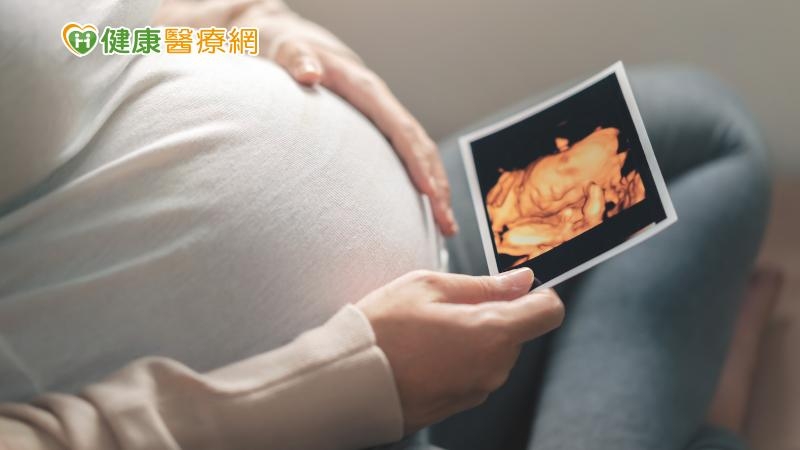 懷孕婦女「藥」小心　醫師籲：慎選用藥！別因懷孕停止治療