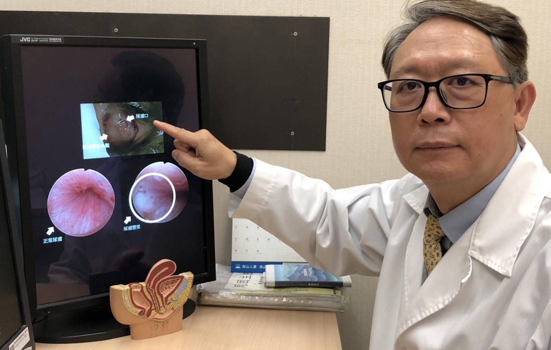 她反覆尿道炎好痛苦! 摸到「圓形腫塊」才揪出真正病因 86 截圖 2023 02 15 上午8.42.54