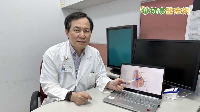 不想HER2乳癌復發轉移 「強化輔助治療」降3成風險
